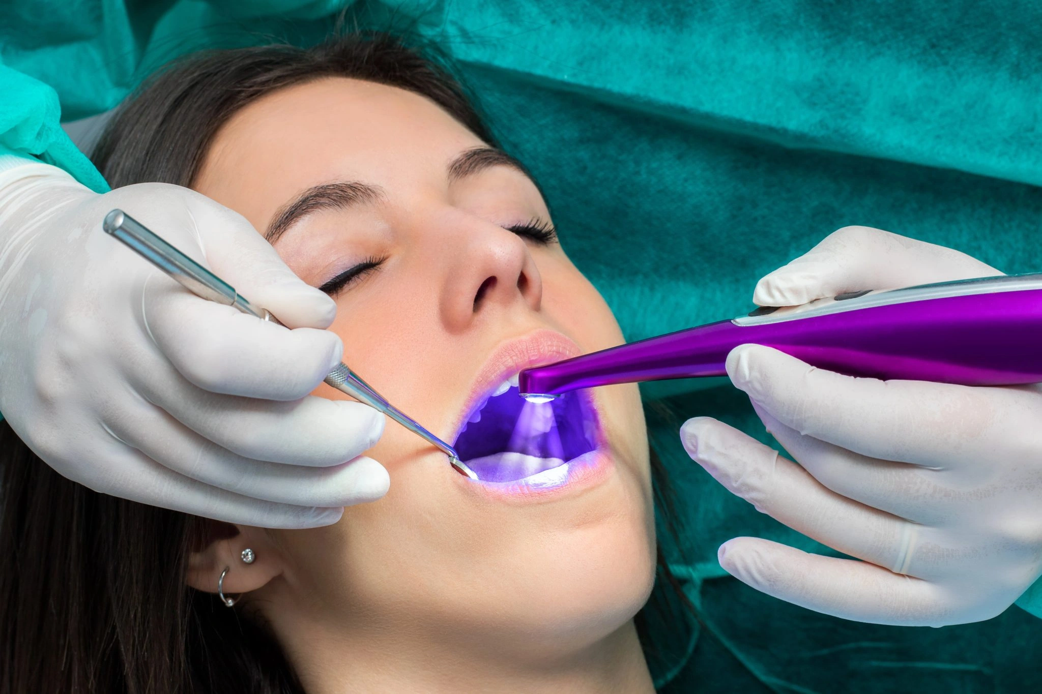 Patient receiving dental sealants during a dental appointment