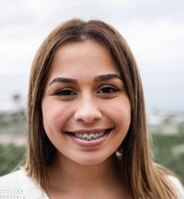 Close up of a straight smile after an orthodontic assessment for clear aligners