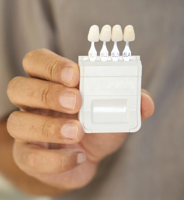 A dentist using a tooth shade guide to match custom porcelain dental veneers